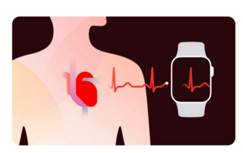 南京苹果13换屏价位_如何启用国行AppleWatch的心电检测功能?