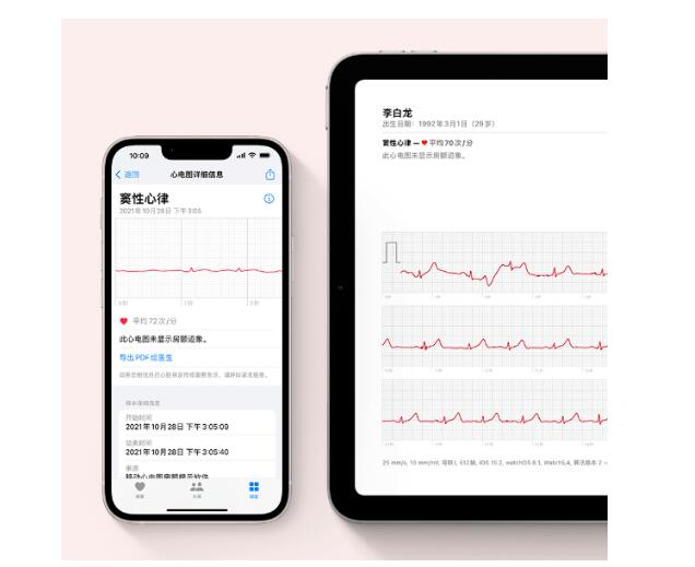 海口苹果手机维修点_苹果官宣心电图 ECG 功能，详细的使用方法来了